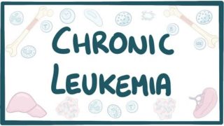 Chronic Leukemia – causes, symptoms, diagnosis, treatment, pathology