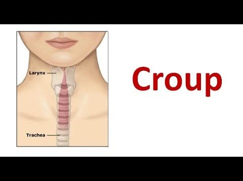 Croup