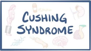 Cushing Syndrome – causes, symptoms, diagnosis, treatment, pathology