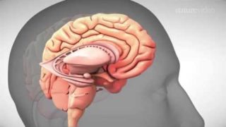 Depression and its treatment