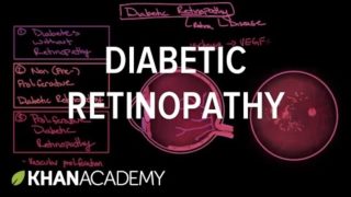 Diabetic retinopathy | Endocrine system diseases | NCLEX-RN | Khan Academy