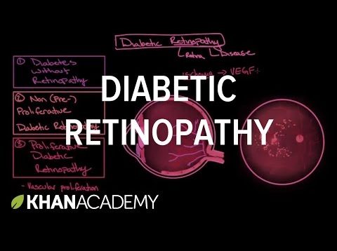 Diabetic retinopathy | Endocrine system diseases | NCLEX-RN | Khan Academy