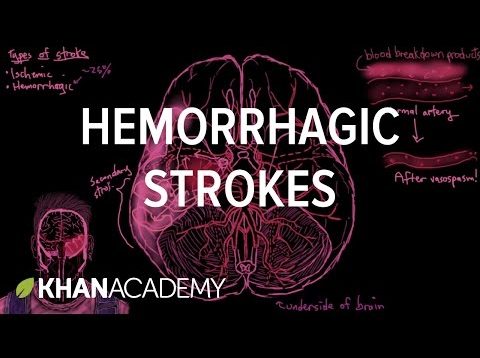 Hemorrhagic strokes | Circulatory System and Disease | NCLEX-RN | Khan Academy
