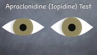 How to Examine Horner’s Syndrome