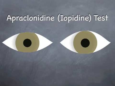 How to Examine Horner’s Syndrome