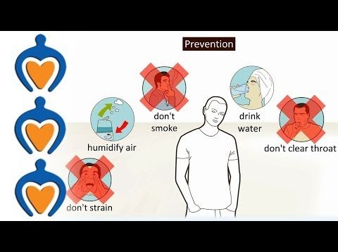 Laryngitis – What is it and how is it treated?