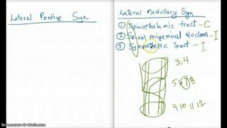 Lateral Inferior Pontine Syndrome