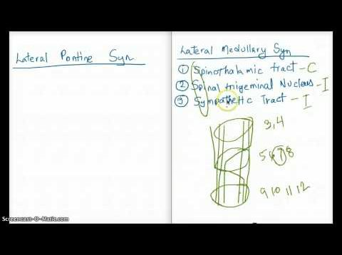 Lateral Inferior Pontine Syndrome