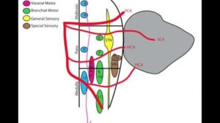 Lateral Medullary (Wallenberg) Syndrome