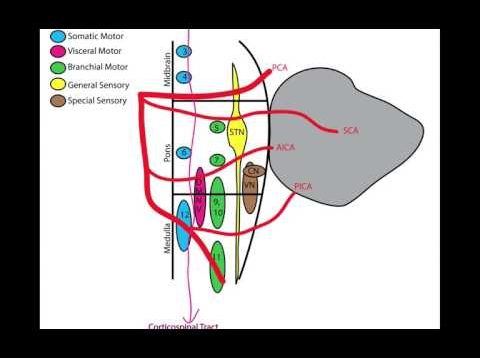Lateral Medullary (Wallenberg) Syndrome