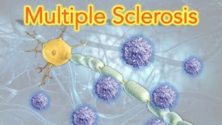 Multiple Sclerosis (MS) Clearly Explained – MADE EASY
