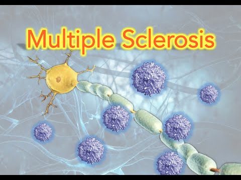Multiple Sclerosis (MS) Clearly Explained – MADE EASY