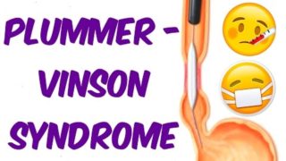 Plummer- Vinson Syndrome in 6 mins!