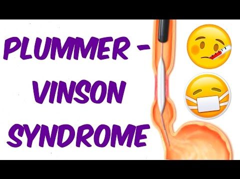 Plummer- Vinson Syndrome in 6 mins!