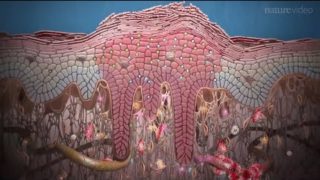 Psoriasis and beyond: targeting the IL-17 pathway