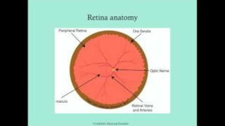Retinopathy of Prematurity – CRASH! Medical Review Series