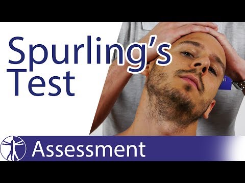 Spurling's Test | Cervical Radicular Syndrome
