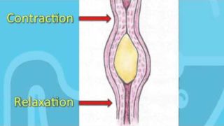 Swallowing Disorders and Achalasia