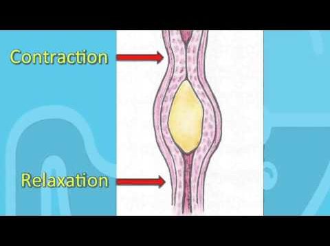 Swallowing Disorders and Achalasia