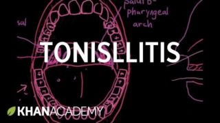 Tonsillitis | Respiratory system diseases | NCLEX-RN | Khan Academy