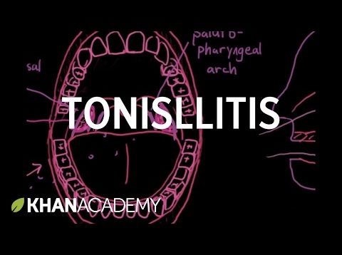 Tonsillitis | Respiratory system diseases | NCLEX-RN | Khan Academy