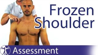 True or Pseudo Frozen Shoulder? | Adhesive Capsulitis Diagnosis True or Pseudo Frozen Shoulder? | Adhesive Capsulitis Diagnosis