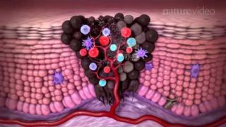 Tumour immunology and immunotherapy