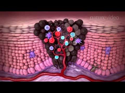Tumour immunology and immunotherapy