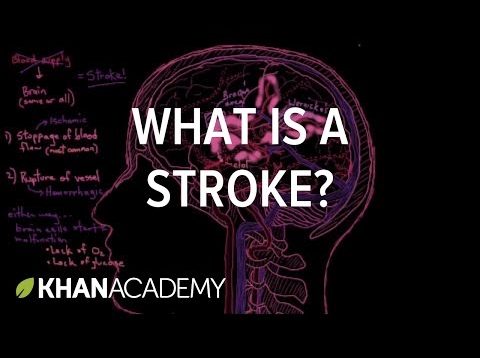 What is a stroke? | Circulatory System and Disease | NCLEX-RN | Khan Academy