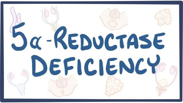 5-alpha reductase deficiency – causes, symptoms, diagnosis, treatment, pathology