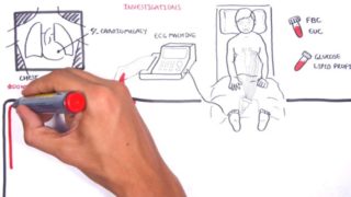 Acute Coronary Syndrome DETAILED Overview (MI, STEMI, NSTEMI)