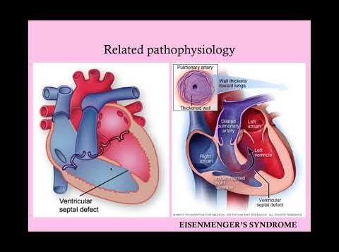 Cardiac Disease in Pregnancy – CRASH! Medical Review Series