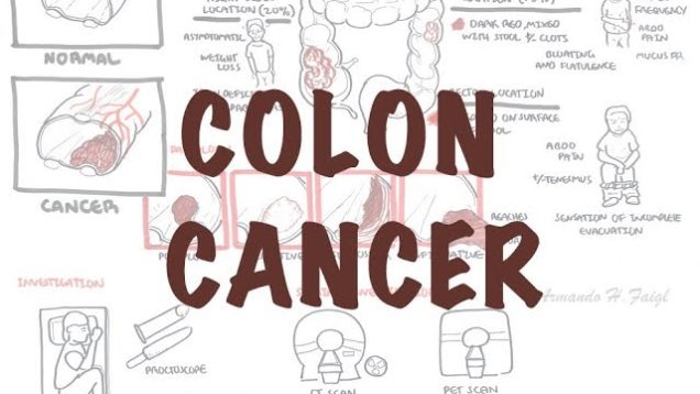Colorectal Cancer – Overview