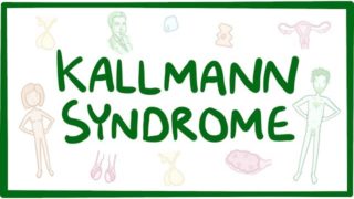 Kallmann syndrome – causes, symptoms, diagnosis, treatment, pathology