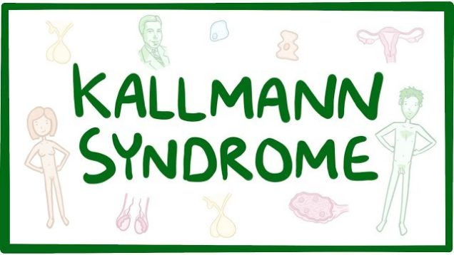 Kallmann syndrome – causes, symptoms, diagnosis, treatment, pathology