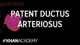 Patent ductus arteriosus | Circulatory System and Disease | NCLEX-RN | Khan Academy