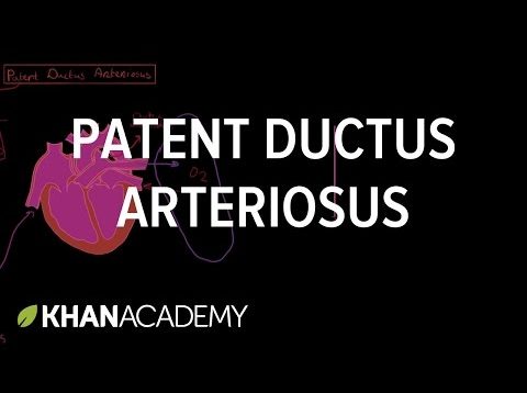 Patent ductus arteriosus | Circulatory System and Disease | NCLEX-RN | Khan Academy