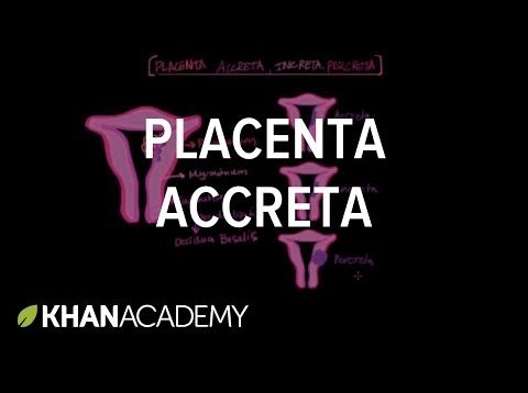Placenta accreta |  Reproductive system physiology | NCLEX-RN | Khan Academy
