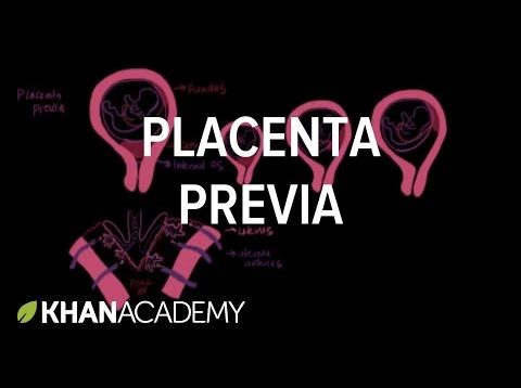 Placenta previa | Reproductive system physiology | NCLEX-RN | Khan Academy