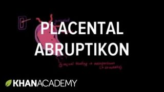 Placental abruption | Reproductive system physiology | NCLEX-RN | Khan Academy