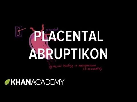 Placental abruption | Reproductive system physiology | NCLEX-RN | Khan Academy