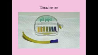Premature Rupture of Membranes – CRASH! Medical Review Series