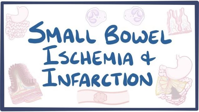 Small bowel ischemia & infarction – causes, symptoms, diagnosis, treatment, pathology
