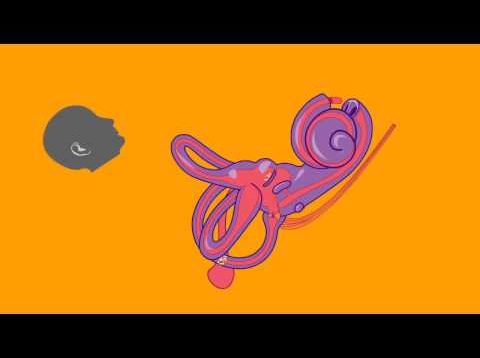 Understand BPPV in One Minute – Michael Teixido, M.D.