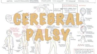 Cerebral Palsy – (DETAILED) Overview