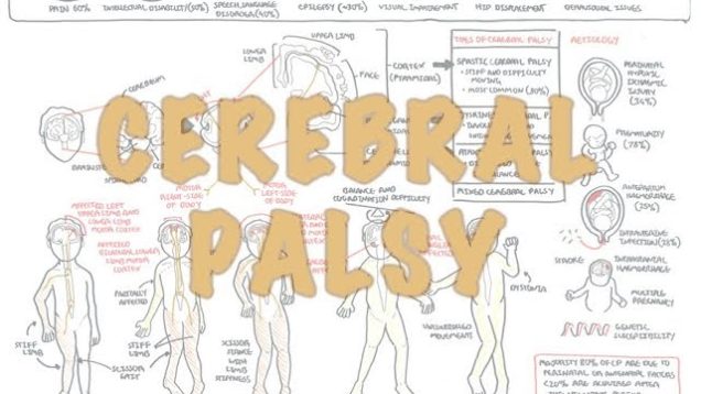 Cerebral Palsy – (DETAILED) Overview