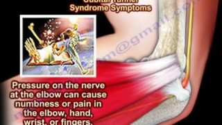 Cubital Tunnel Syndrome – Everything You Need To Know – Dr. Nabil Ebraheim