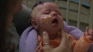 Infant girl with whooping cough
