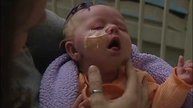 Infant girl with whooping cough