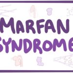 Marfan Syndrome - causes, symptoms, diagnosis, treatment, pathology